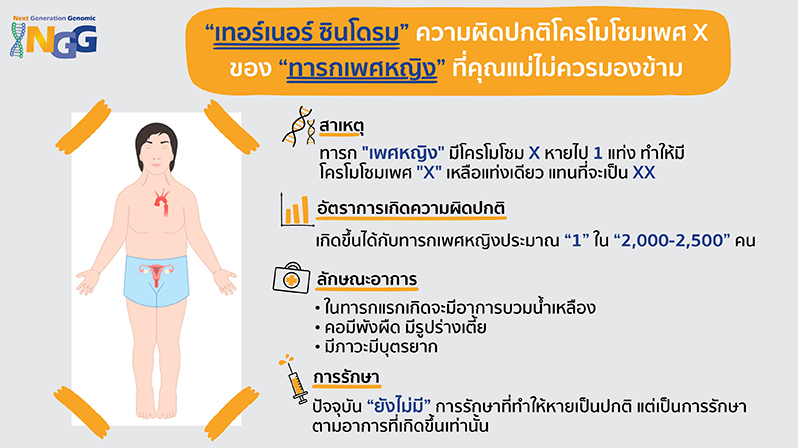 เทอร์เนอร์ซินโดรม (Turner Syndrome) ความผิดปกติโครโมโซมเพศ X ของทารกเพศหญิงที่คุณแม่ไม่ควรมองข้าม