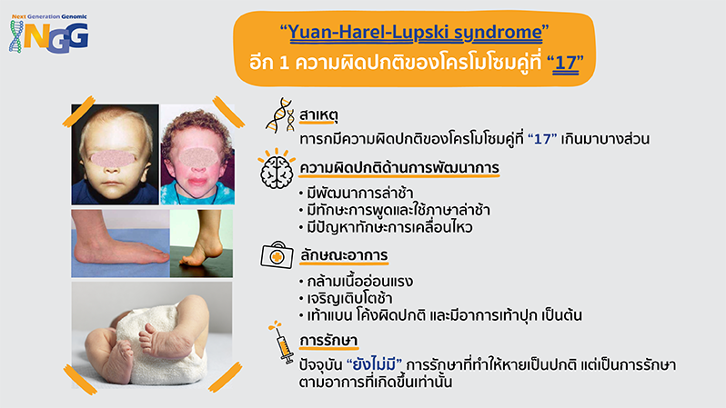 Yuan-Harel-Lupski syndrome อีก 1 ความผิดปกติของโครโมโซมคู่ที่ 17