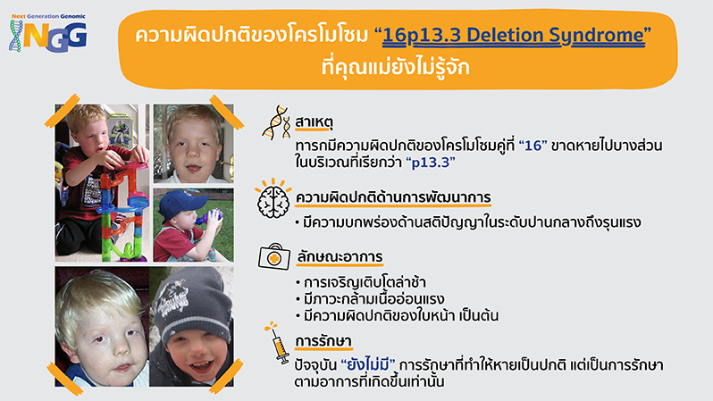 ความผิดปกติของโครโมโซม 16p13.3 deletion syndrome ที่คุณแม่ยังไม่รู้จัก