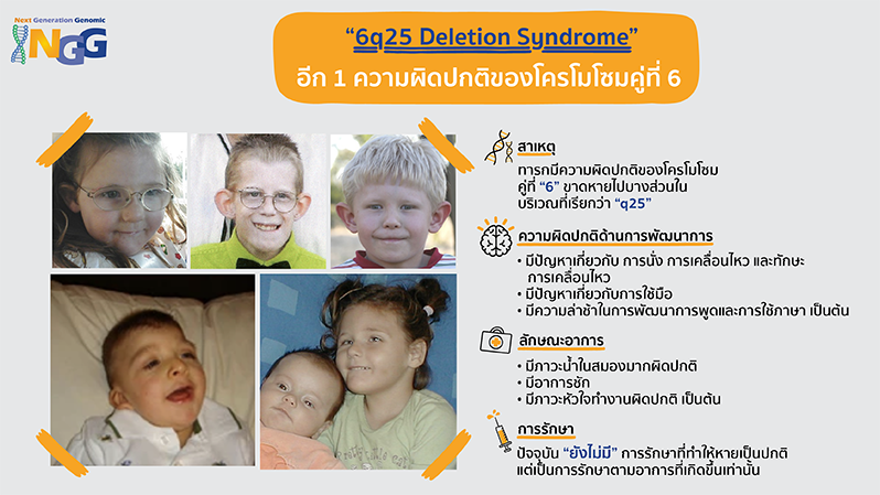 6q25 deletion syndrome อีก 1 ความผิดปกติของโครโมโซมคู่ที่ 6